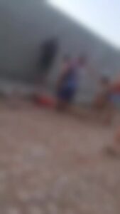 Ataque de pitbulls em Extremoz resulta em amputação de braços de homem