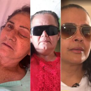 RN: Pacientes que perderam a visão em mutirão de catarata aguardam indenização